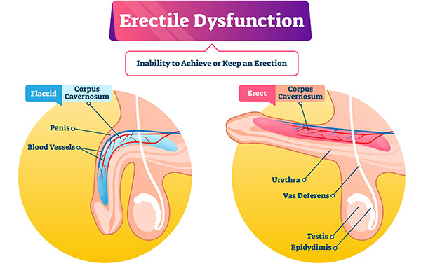 The image is an educational graphic illustrating the structure of a human erectile dysfunction mechanism, showing the penis and its components with labels in English.