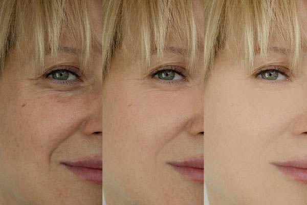 The image shows a person s face with three different skin tones, likely representing the effects of aging or various skincare treatments.